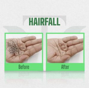 Hair Fall